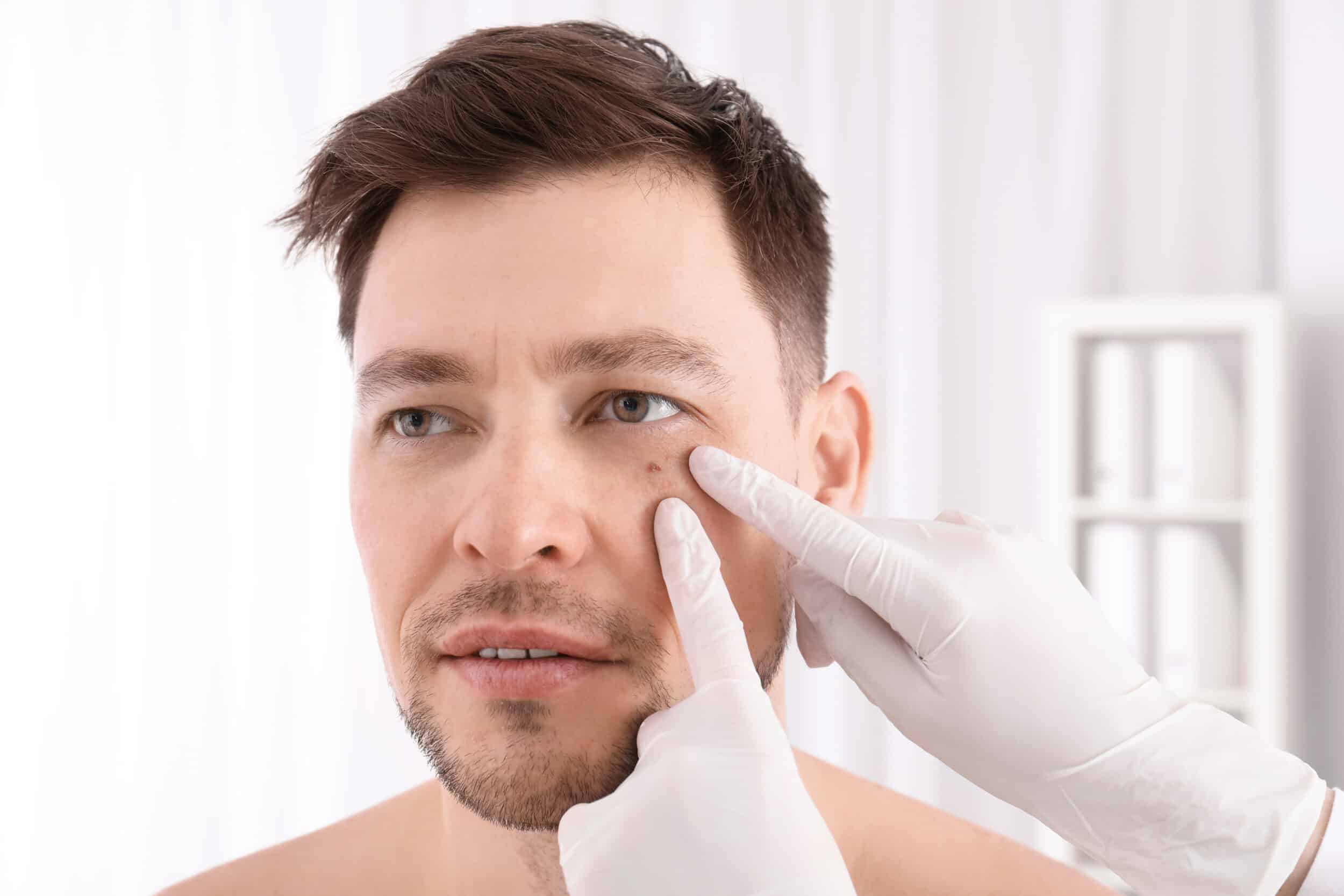 Doctor evaluating a male patient’s face during skin cancer screening in San Antonio, TX